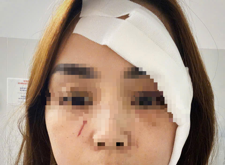 Một phụ nữ ở Nha Trang bị người không quen biết xông vào nhà rạch mặt - Ảnh 1.