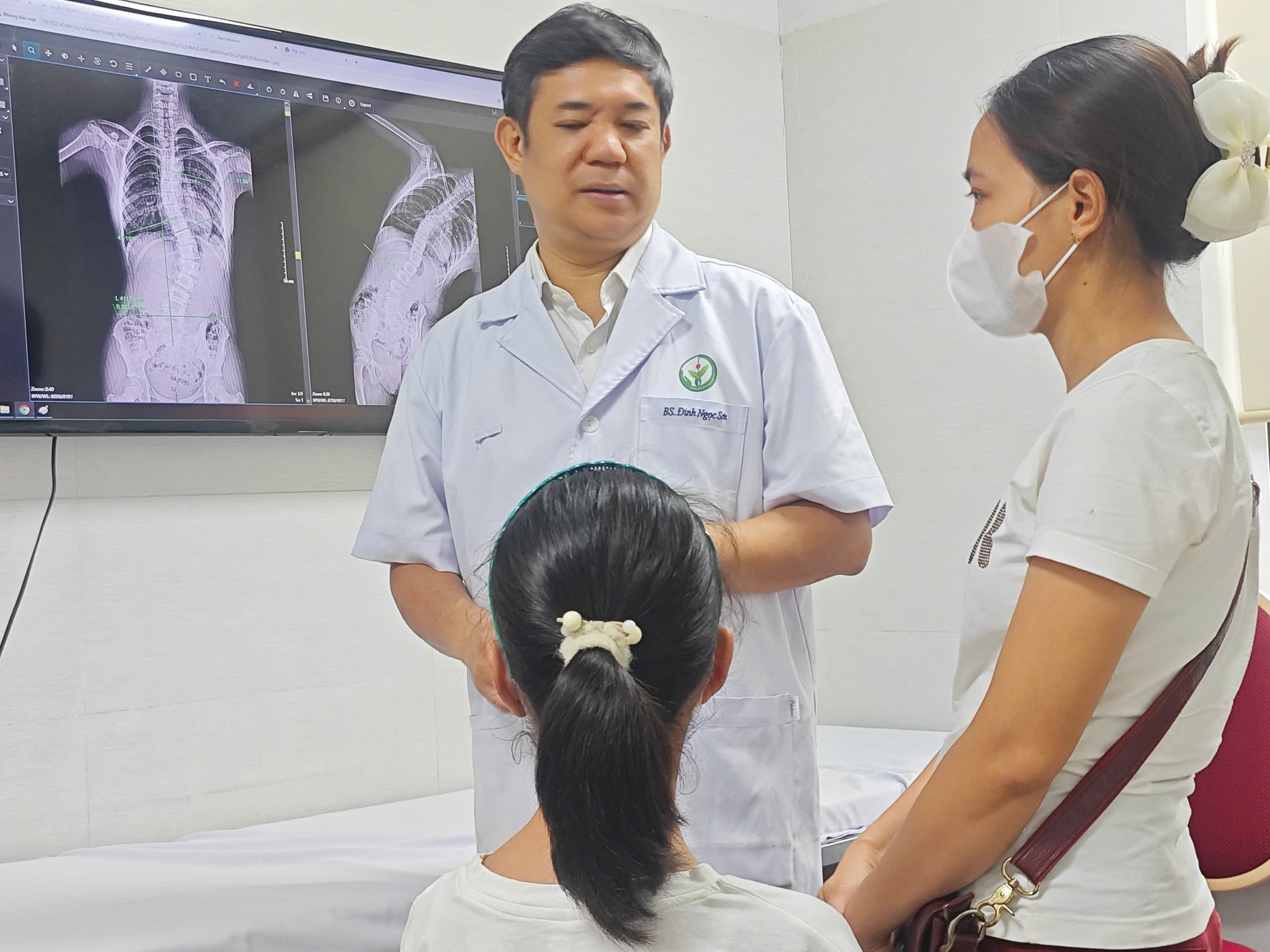 Nhiều trẻ gù vẹo cột sống phát hiện muộn - Ảnh 1. Nhiều trẻ gù vẹo cột sống phát hiện muộn - Ảnh 1.