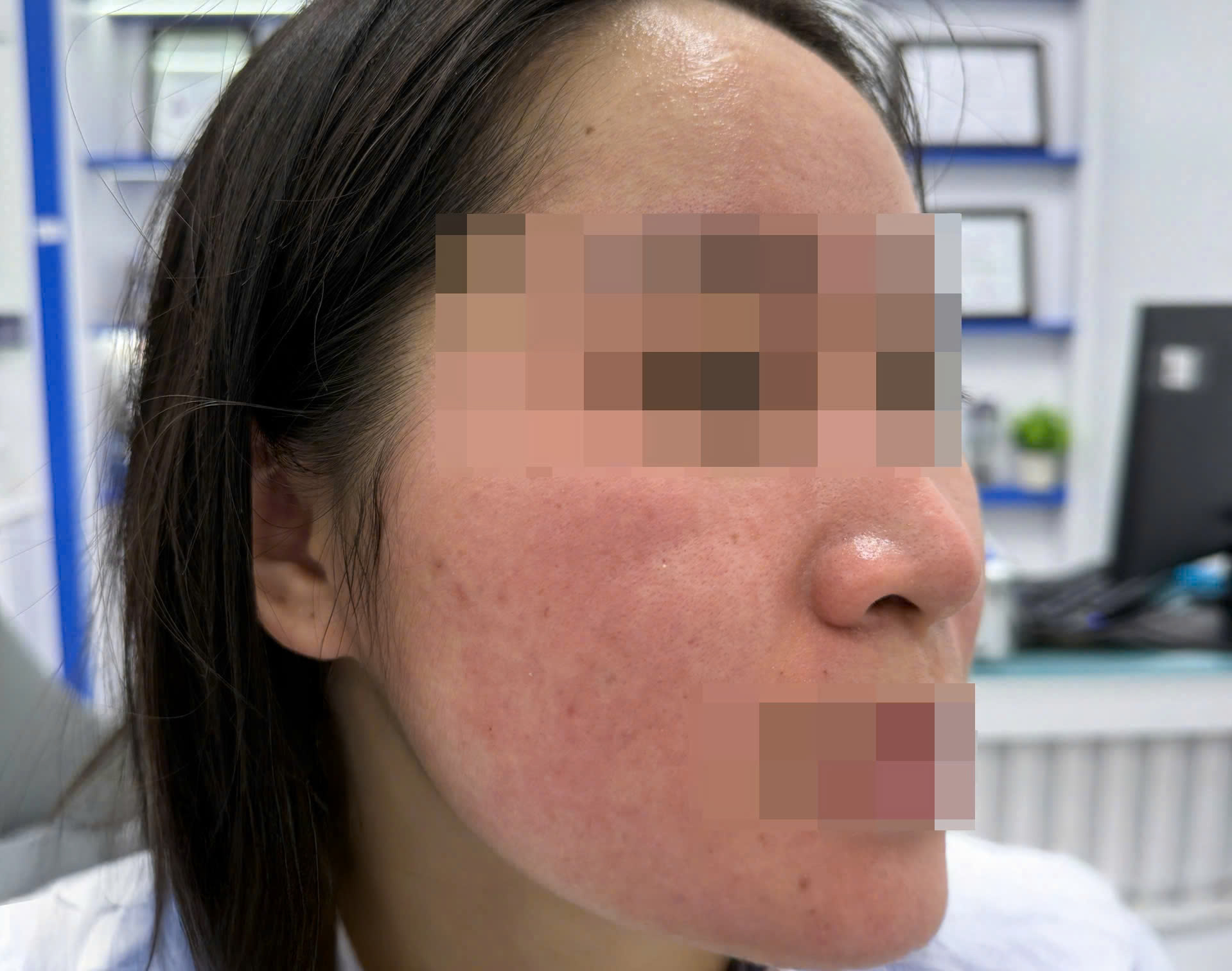 Hết trị bách bệnh, lại đến dùng nước cốt chanh trị mụn - Ảnh 1. nước cốt chanh - Ảnh 1.