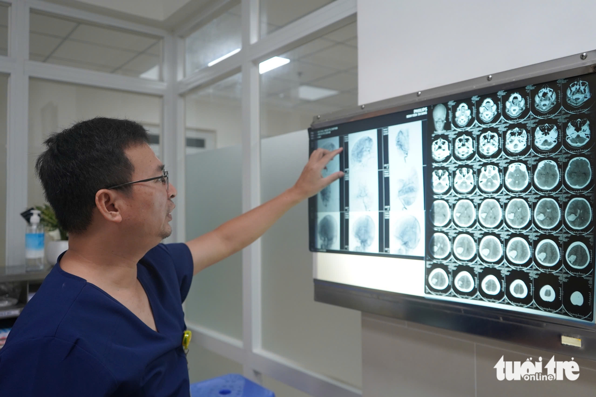 Cháu bé 13 tuổi đột quỵ khi tập văn nghệ: Cảnh giác dấu hiệu dễ bỏ qua - Ảnh 2.