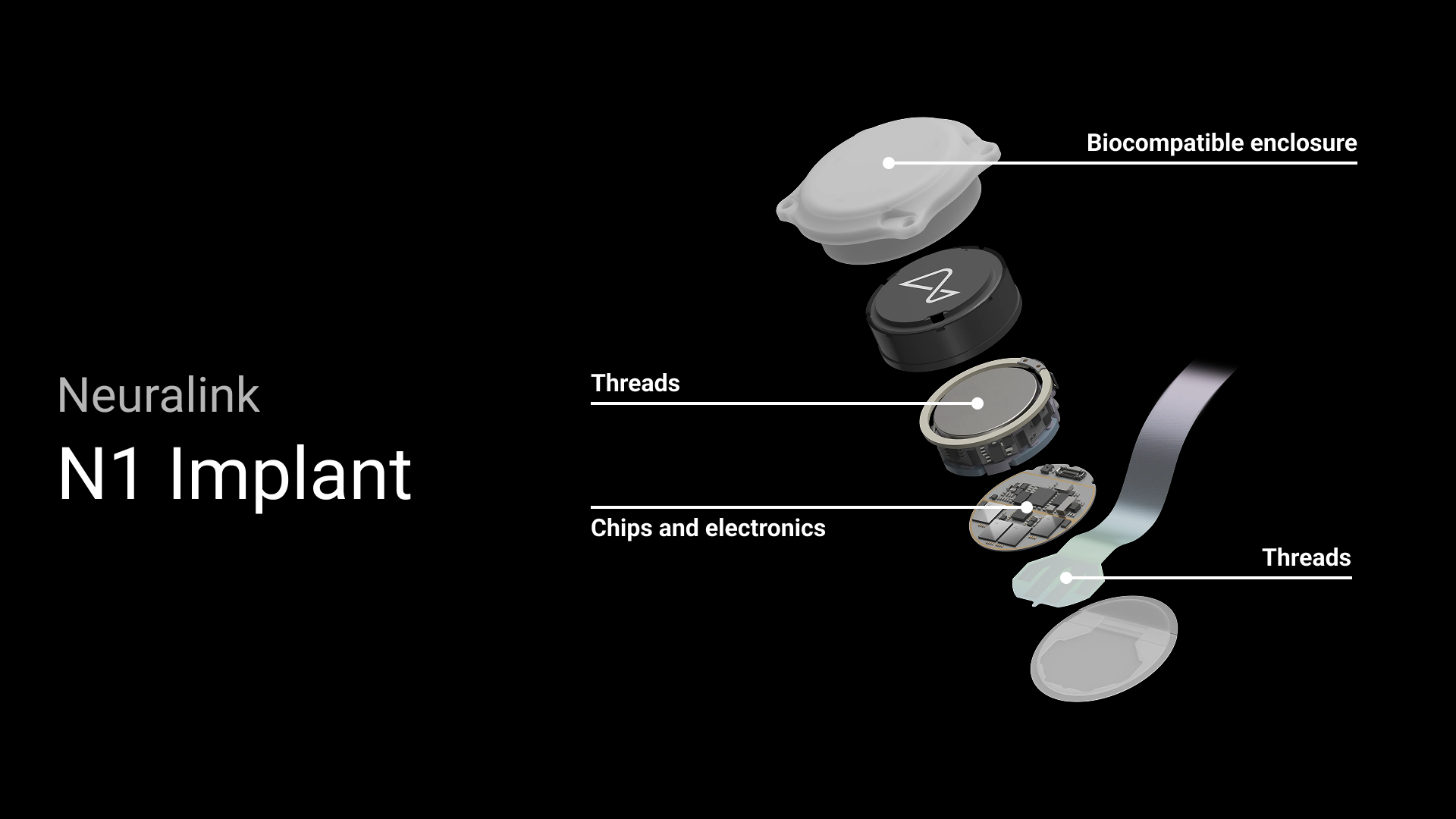 Neuralink: Điều khiển máy tính bằng não và hy vọng cho người mù - Ảnh 1.