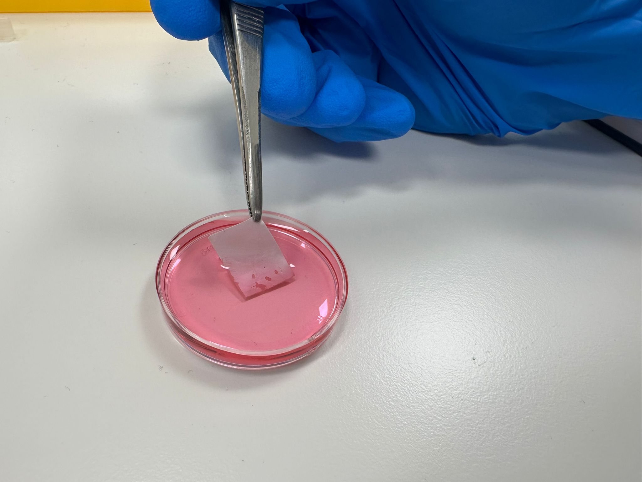 Průlom v biologické umělé kůži pomáhá rychle a bezpečně léčit popáleniny - Foto 1. da nhân tạo - Ảnh 1.