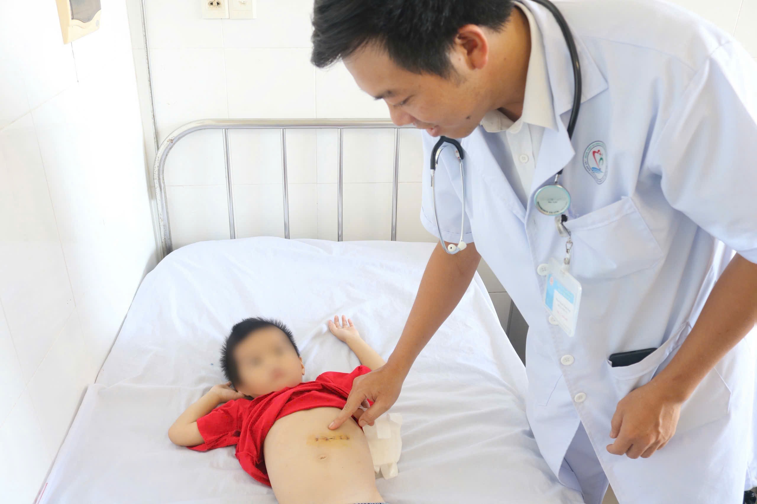 Phẫu thuật gắp búi tóc nặng nửa ký khỏi dạ dày bệnh nhi 5 tuổi- Ảnh 1. Phẫu thuật lấy búi tóc nặng nửa ký khỏi dạ dày bệnh nhi 5 tuổi - Ảnh 1.