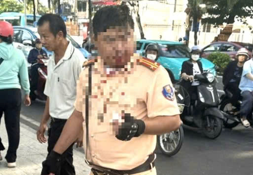 Foreigner punches Vietnamese traffic police officer on duty- Ảnh 1. Foreigner punches Vietnamese traffic police officer on duty- Ảnh 1.