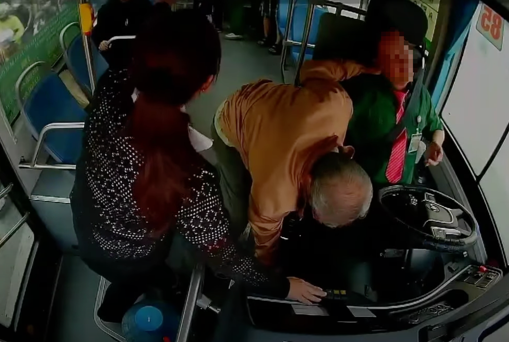 đột quỵ - Ảnh 1.