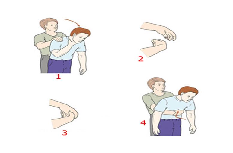 Trẻ dễ bị hóc đầu ngòi bút, nhận biết và xử trí ra sao? - Ảnh 4.