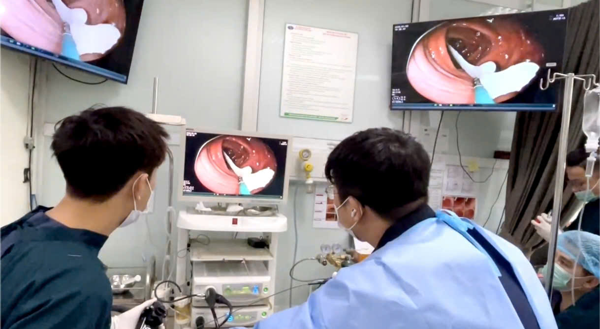 Sụt 2kg trong 2 tuần, bác sĩ phát hiện sán dây dài gần 1 mét ‘ngọ nguậy’ trong đại tràng - Ảnh 1. sán dây - Ảnh 1.