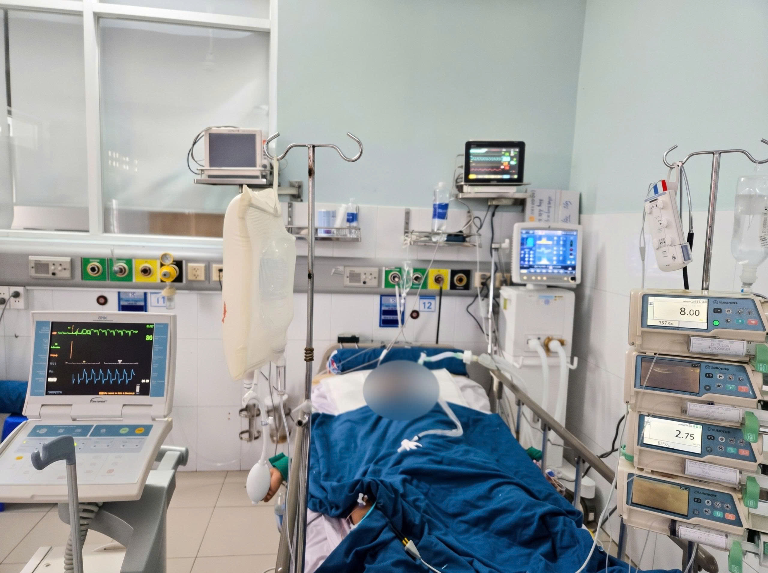 Hút 2-3 gói thuốc mỗi ngày, người đàn ông 50 tuổi nguy kịch vì nhồi máu cơ tim - Ảnh 1.
