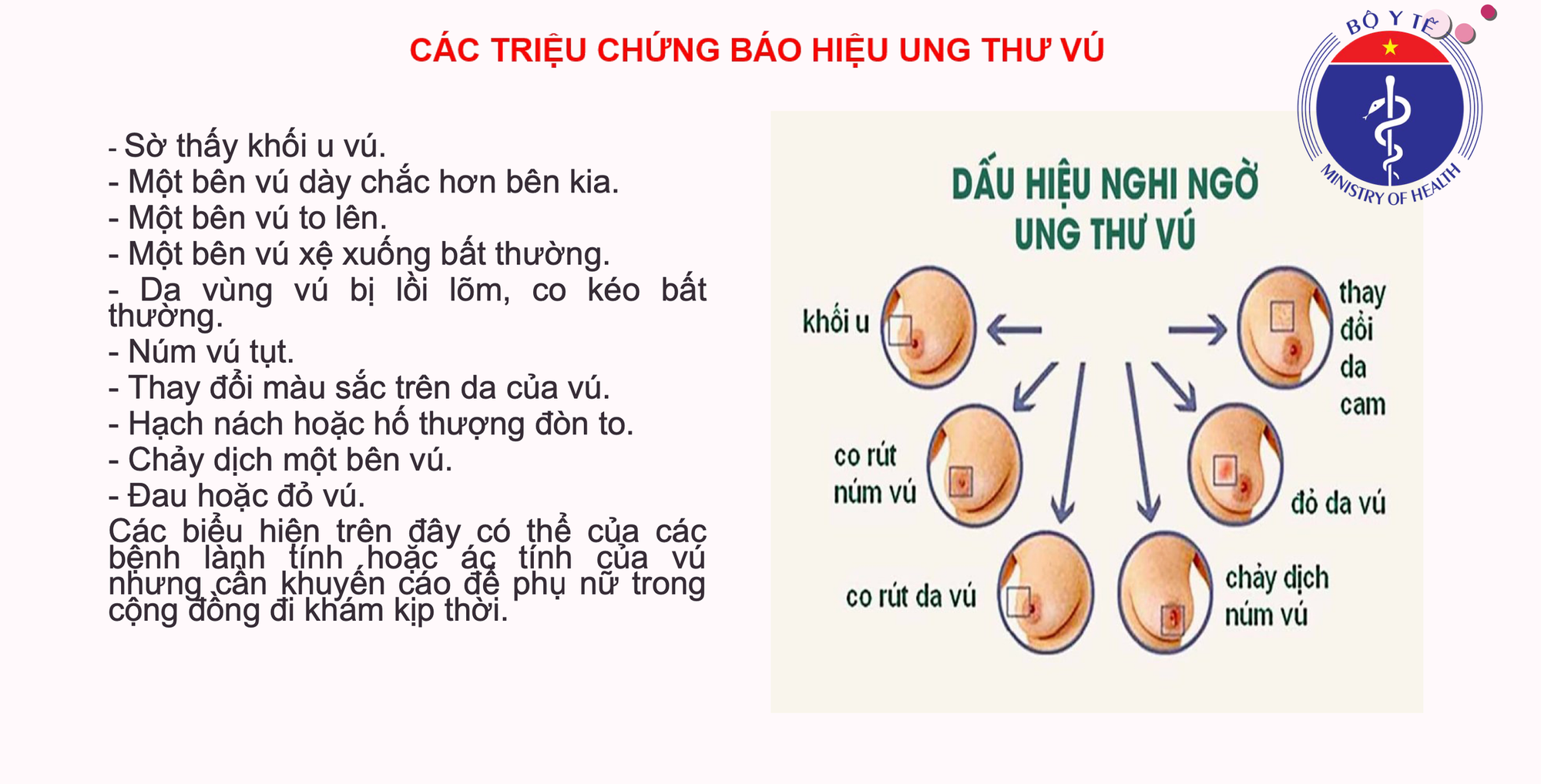 5 loại ung thư người Việt mắc phải nhiều nhất: Ung thư vú dẫn đầu, tiếp theo là gì? - Ảnh 3.