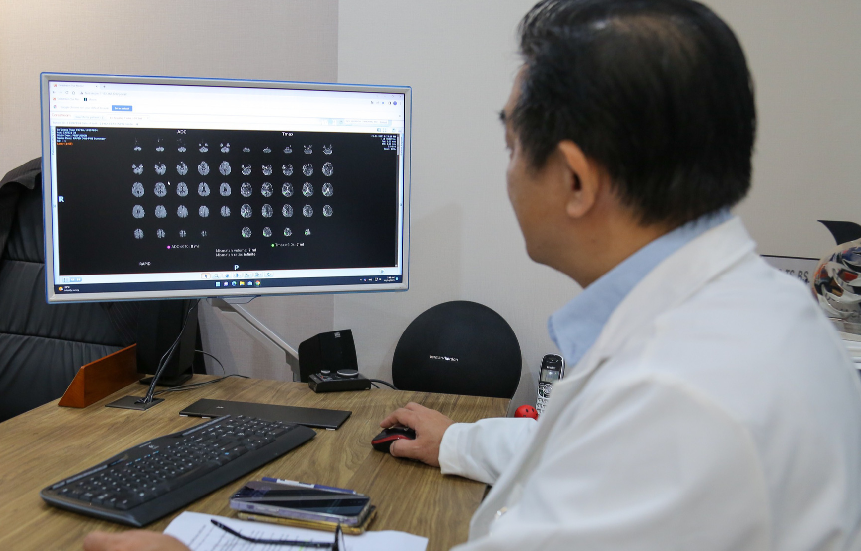 Chủ tịch Hội Đột quỵ TP.HCM: 'Đột quỵ là một trong 3 bệnh có nguy cơ mắc cao nhất suốt đời'  - Ảnh 1.