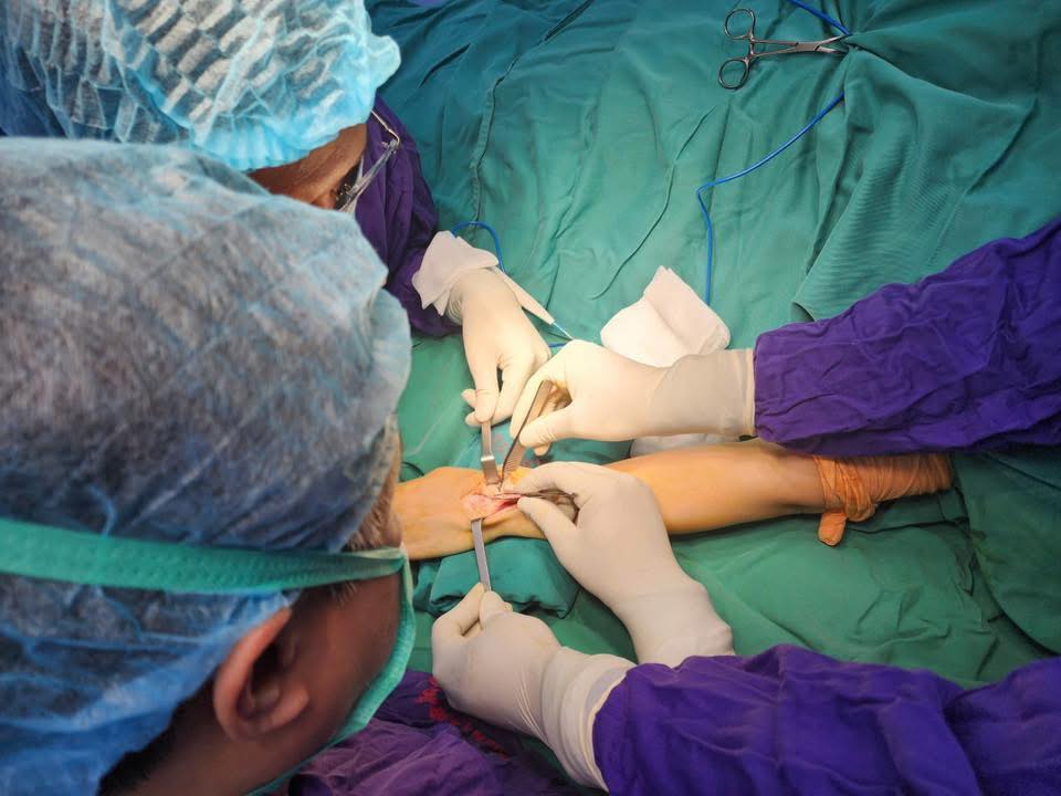 trật khớp - Ảnh 1.