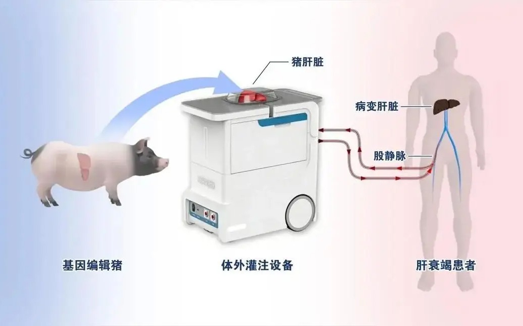 Trung Quốc đảo ngược suy gan cấp bằng gan lợn chỉnh sửa gien ngoài cơ thể