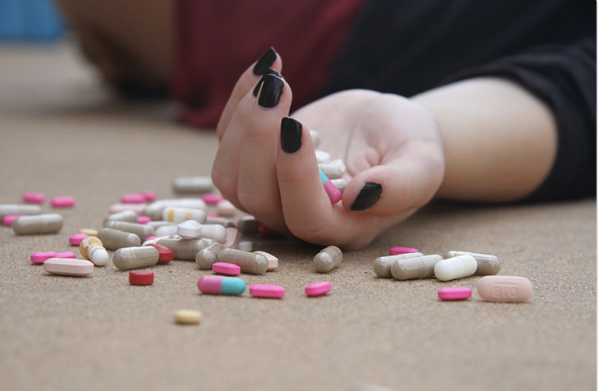 dị ứng - Ảnh 1.