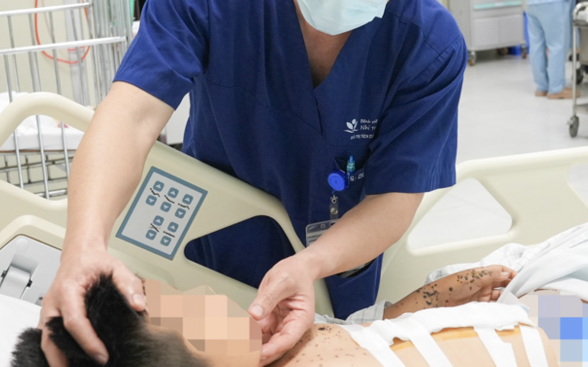 Bé trai 9 tuổi nguy kịch vì kíp nổ tự chế trong dịp Tết, bác sĩ cảnh báo nguy cơ