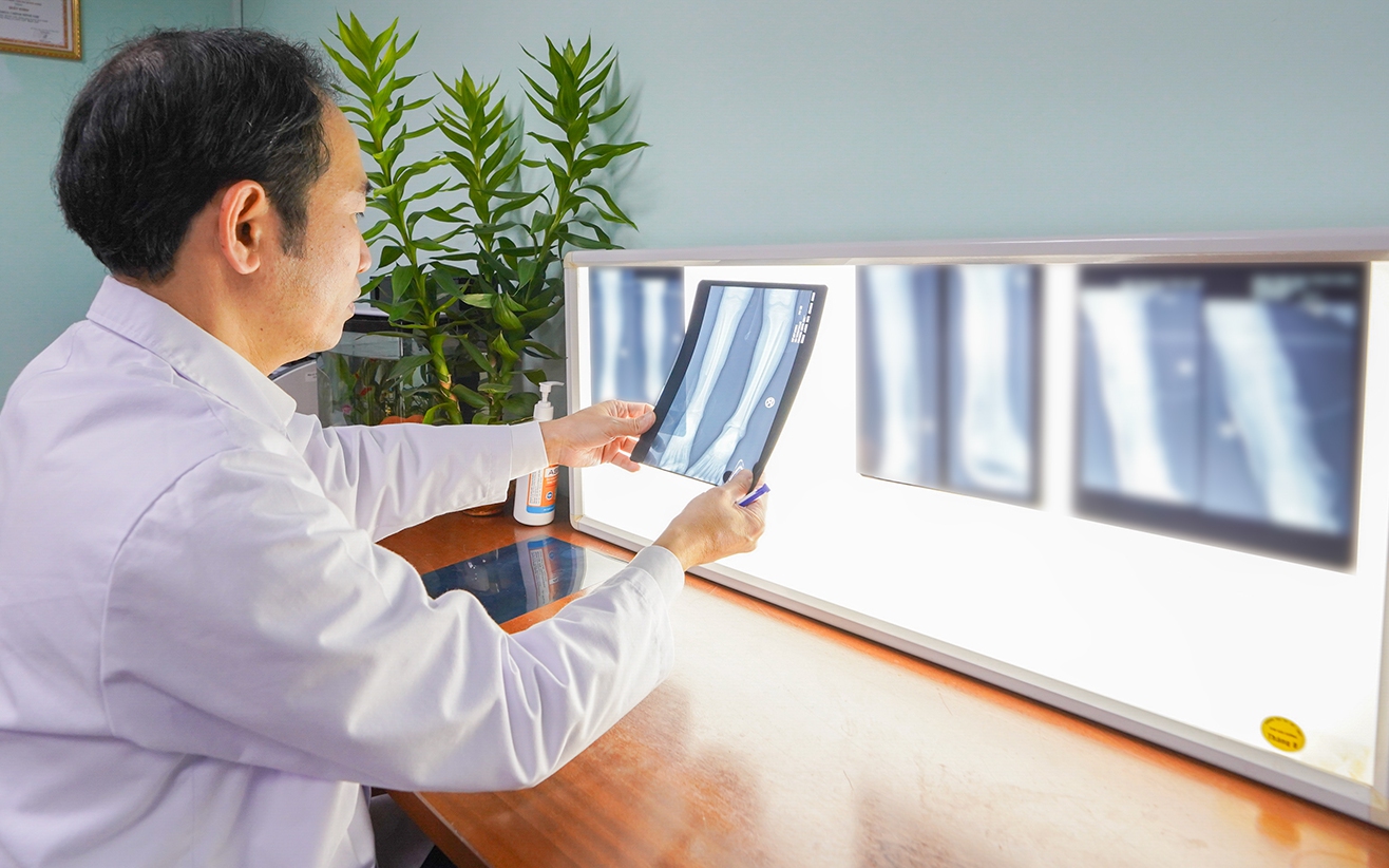 Ca phẫu thuật ghép xương vi phẫu cứu chi thành công cho bé 8 tuổi tại Bệnh viện Nhi Trung ương
