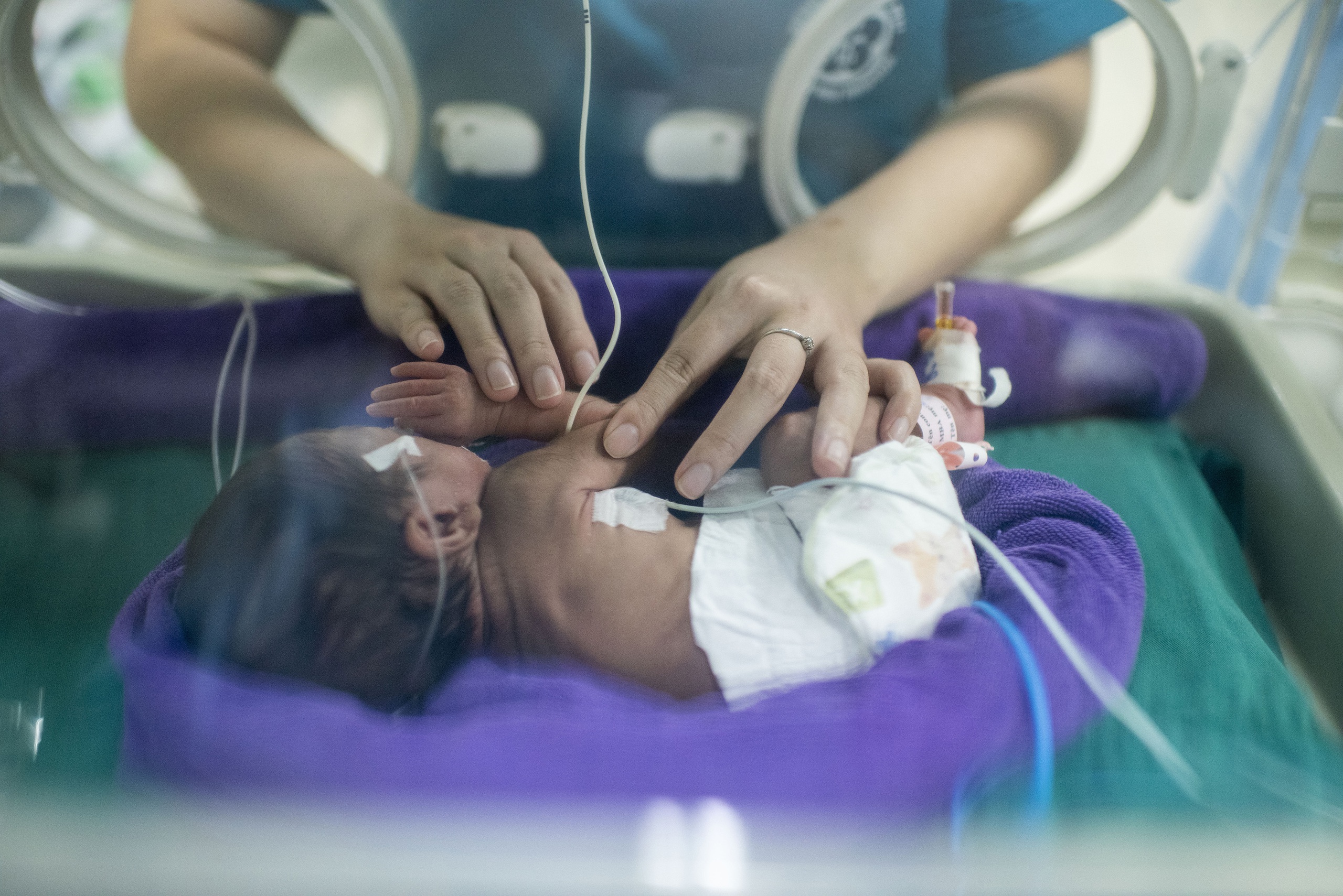 Những sinh linh bé nhỏ bắt đầu cuộc đời bằng một cuộc chiến - Ảnh 1.