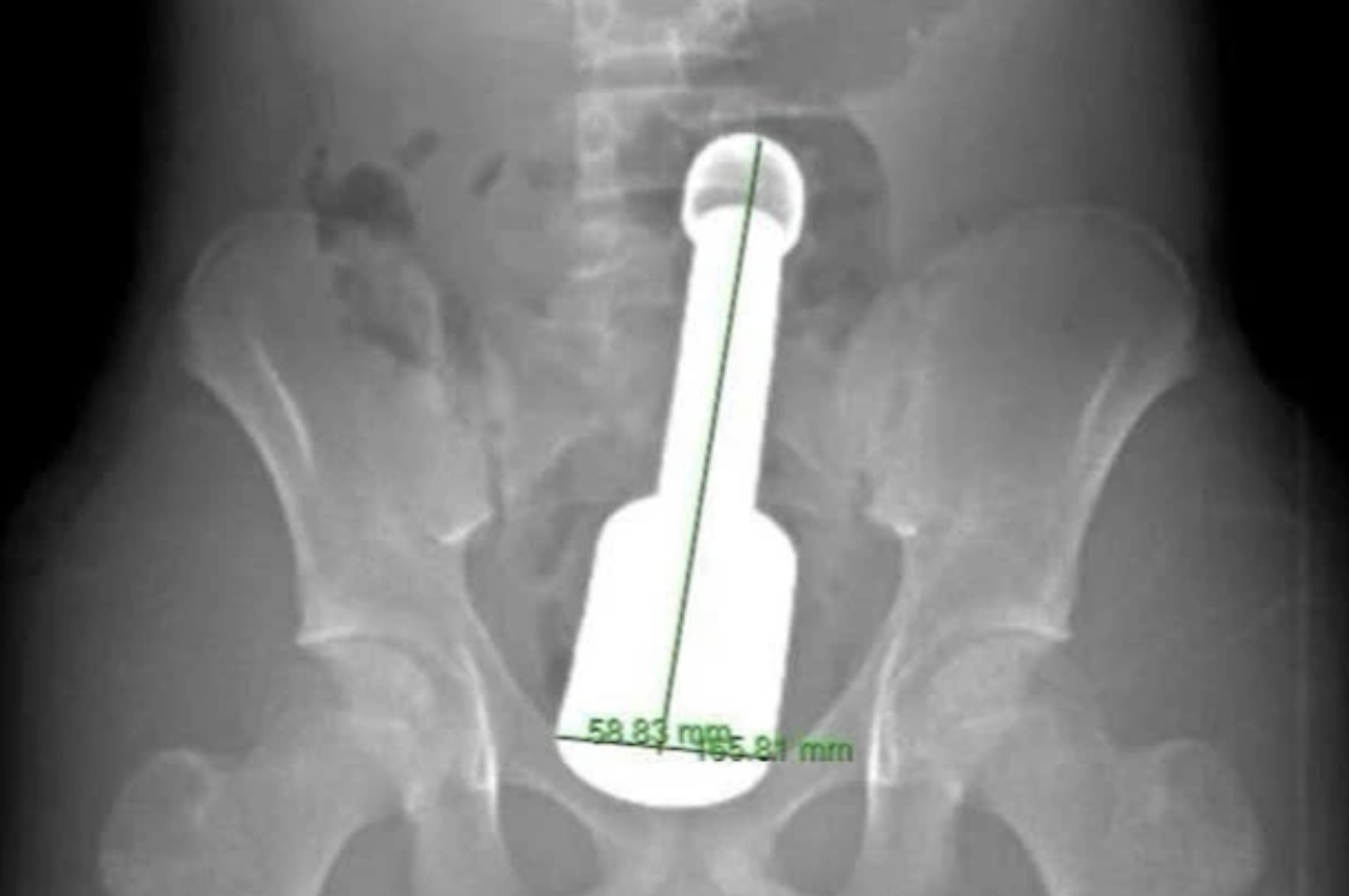 cấp cứu - Ảnh 1.