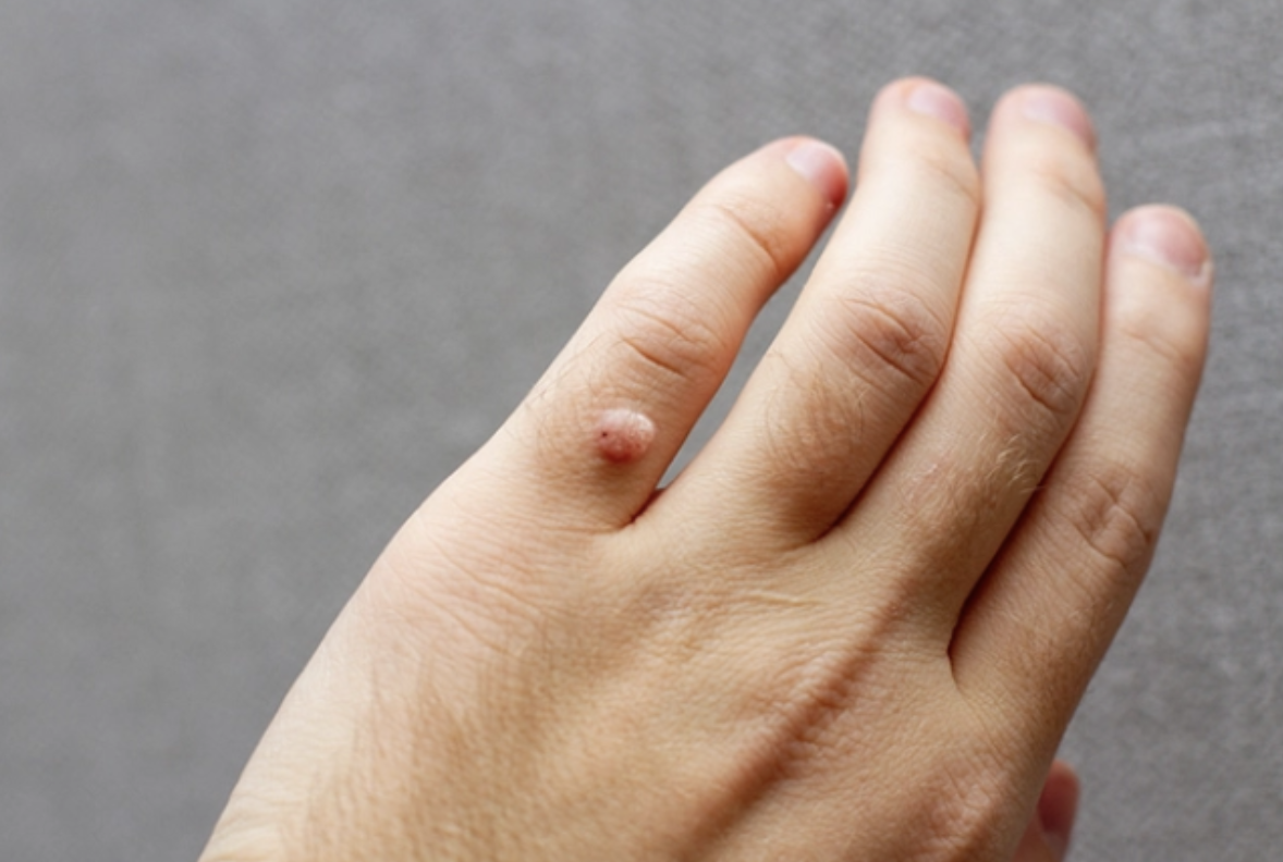 hạt cơm - Ảnh 1.