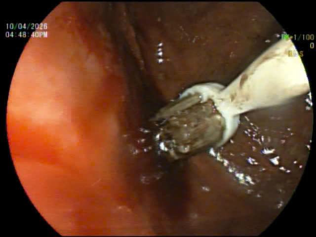 bàn chải - Ảnh 1.