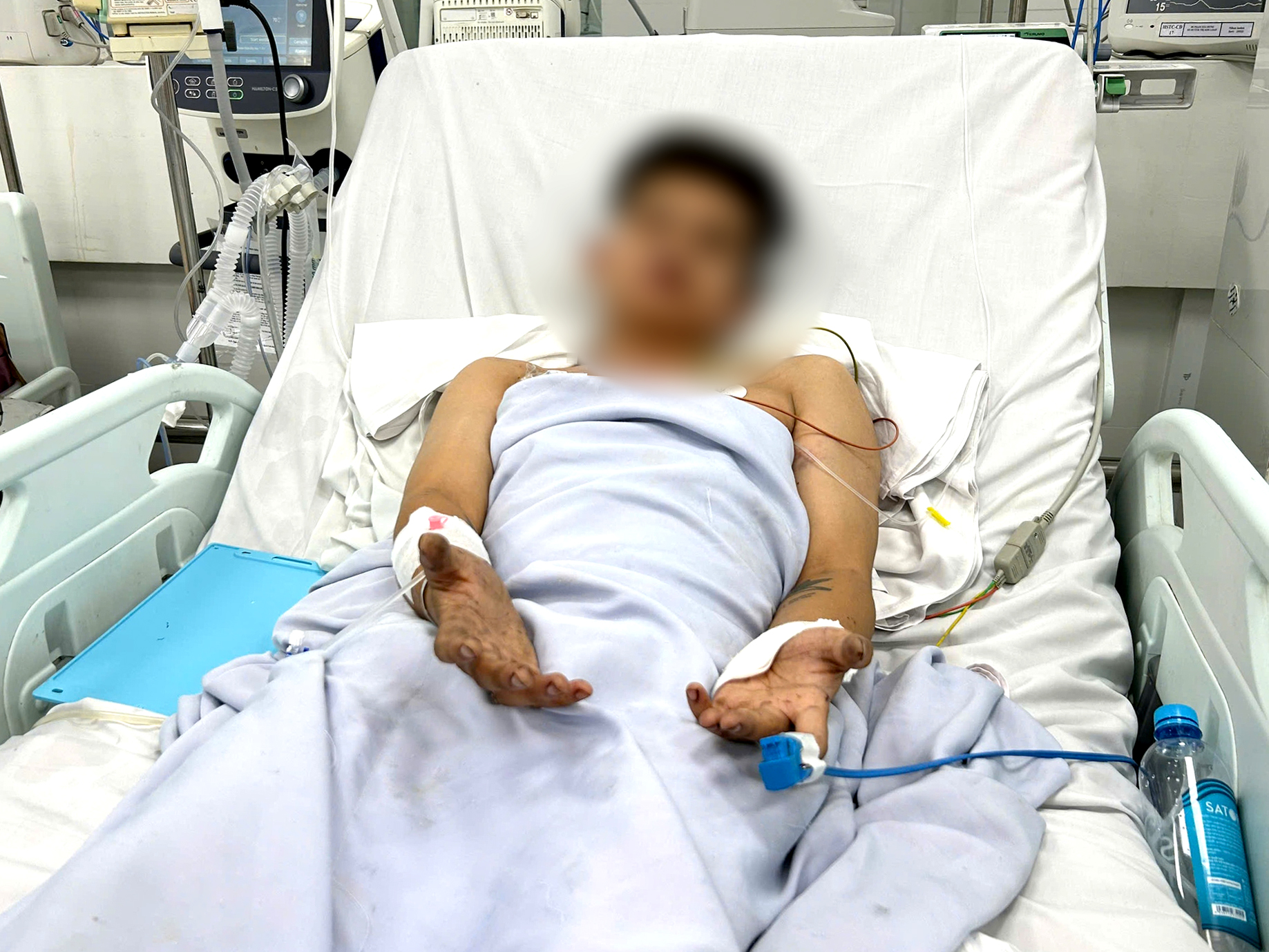 Vụ cháy nhà trọ ở TP.HCM, 2 người tử vong: Nhiều nạn nhân tiên lượng bệnh nặng hồi phục ngoạn mục - Ảnh 1.