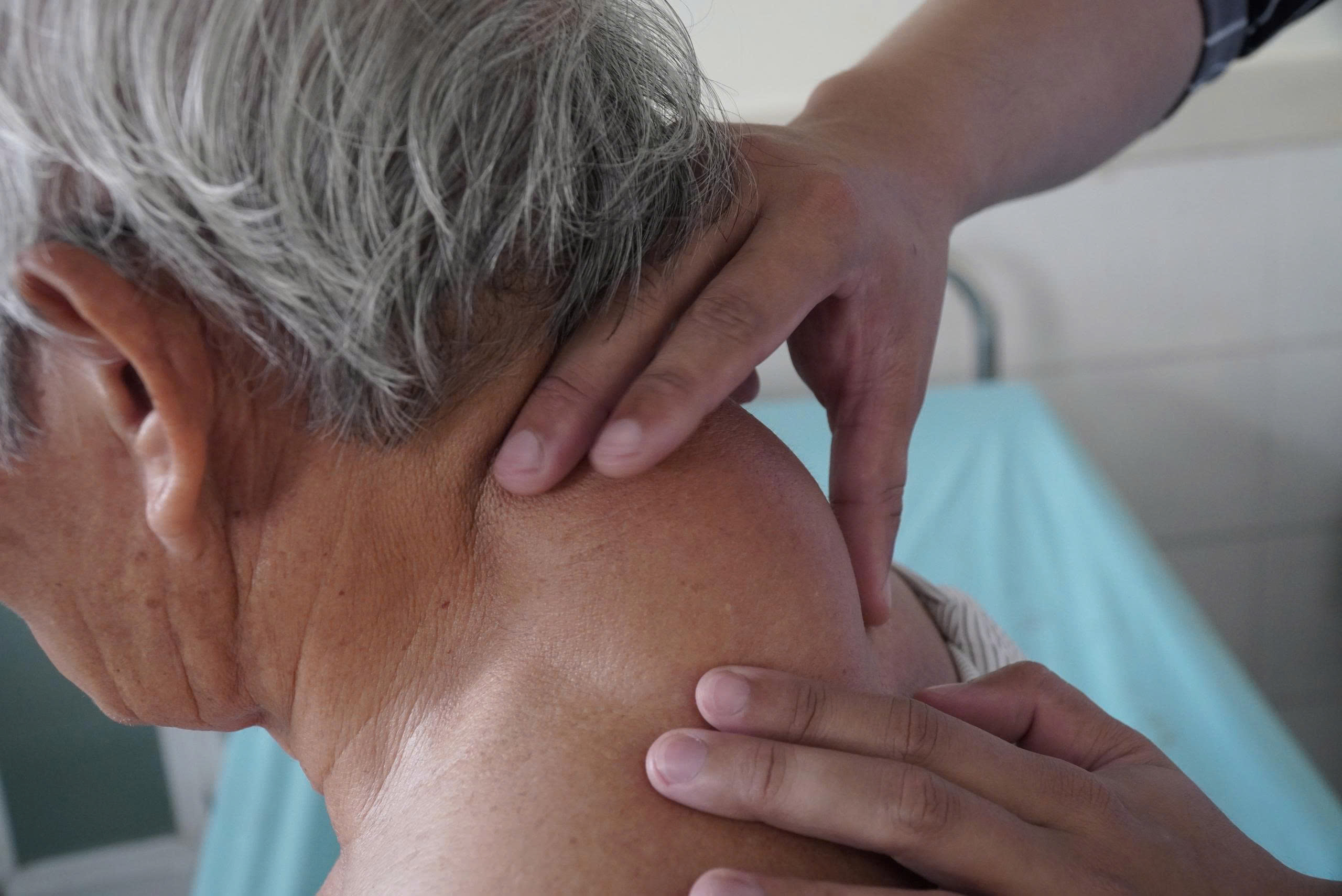 Phẫu thuật bóc khối u 'khổng lồ' vùng sau cổ suốt hơn 40 năm cho cụ ông 72 tuổi - Ảnh 3.