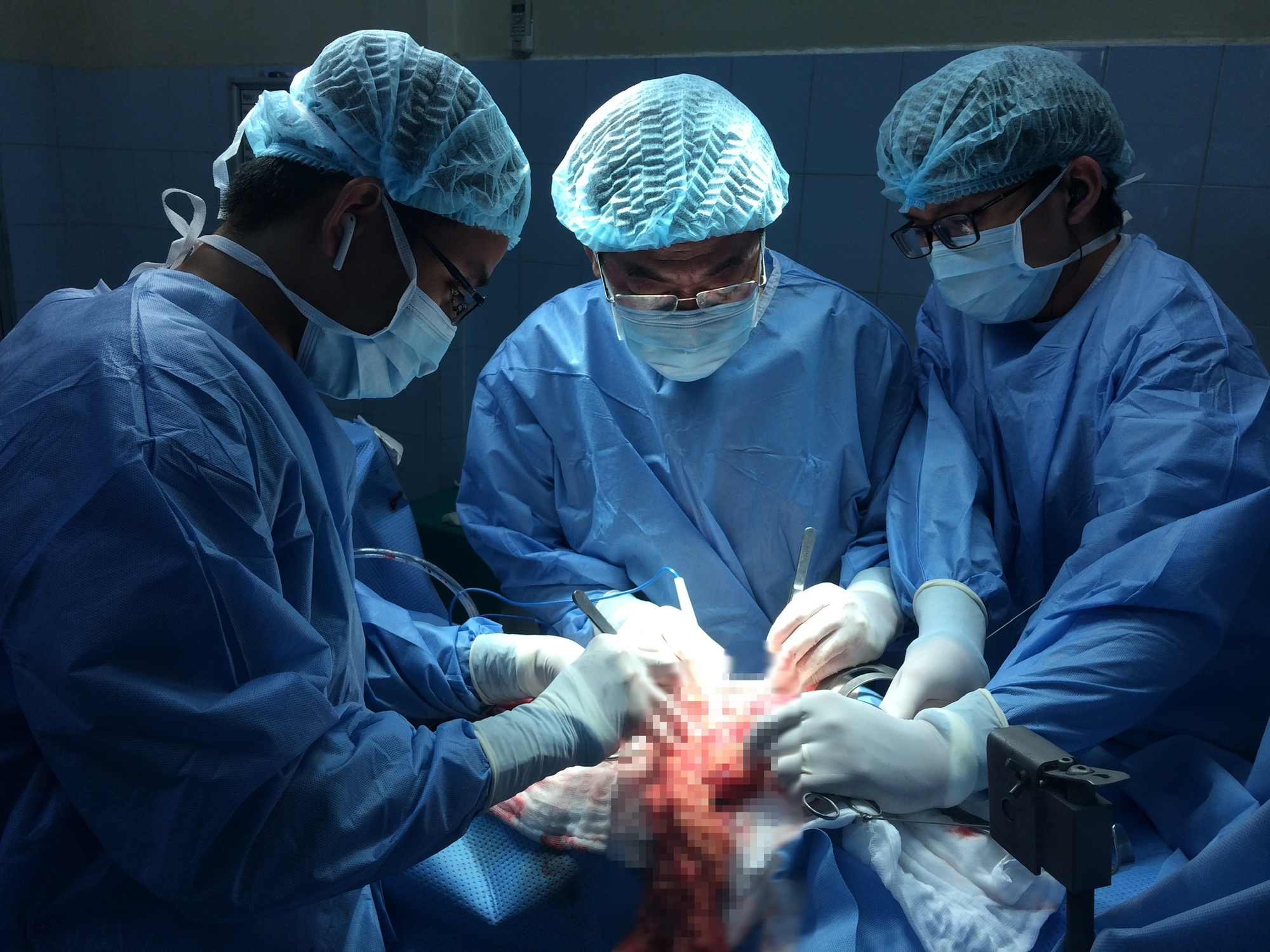 Nhiễm vi khuẩn H. pylori có thể gây ung thư dạ dày, phòng lây nhiễm thế nào? - Ảnh 1.