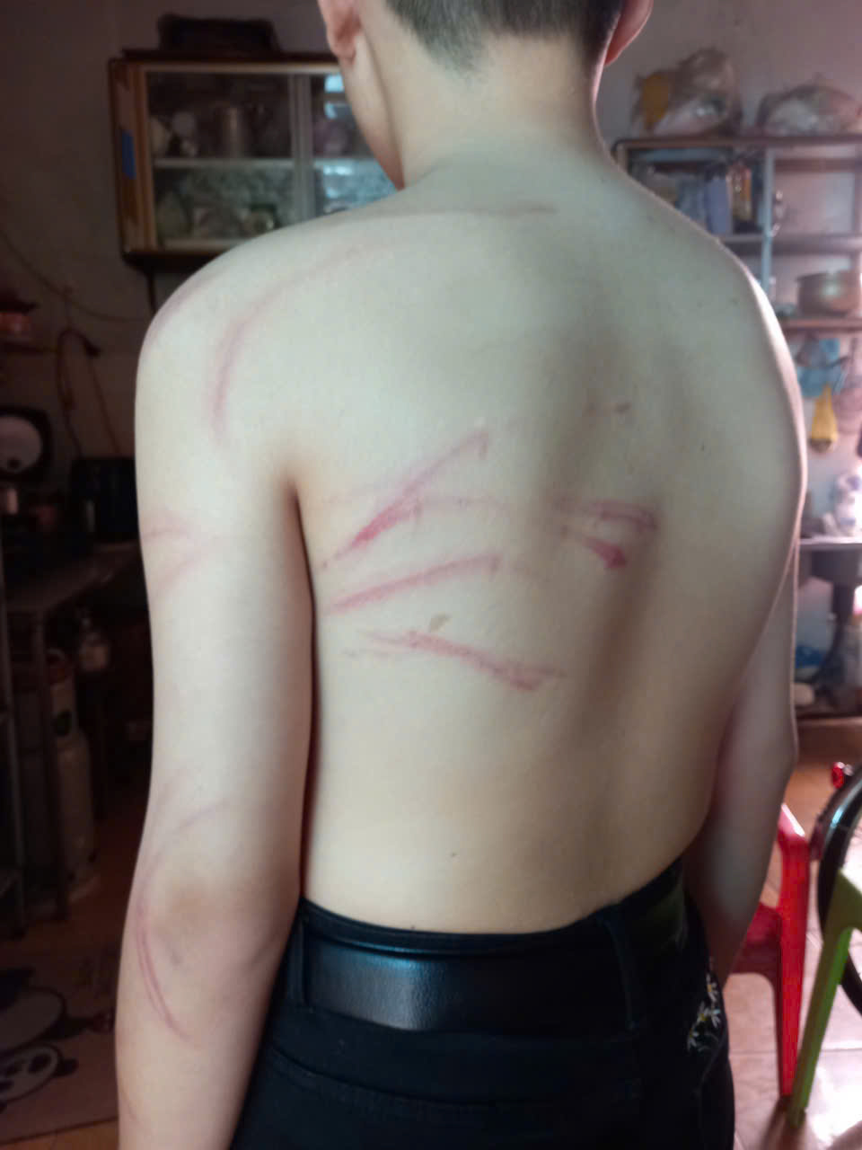 Phụ Huynh Báo Động: Học Sinh Bị Thầy Giáo Dạy Thêm Đánh Dùng Cây