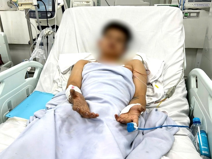 ngạt khói - Ảnh 1.