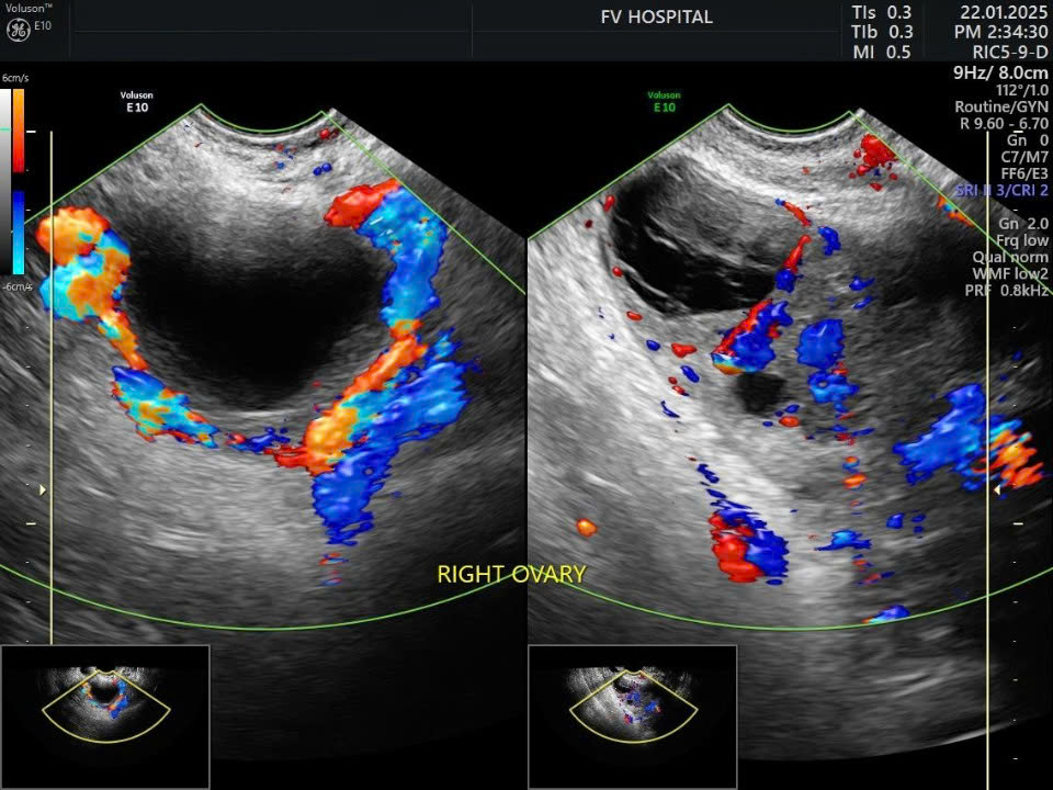 biến chứng - Ảnh 2.