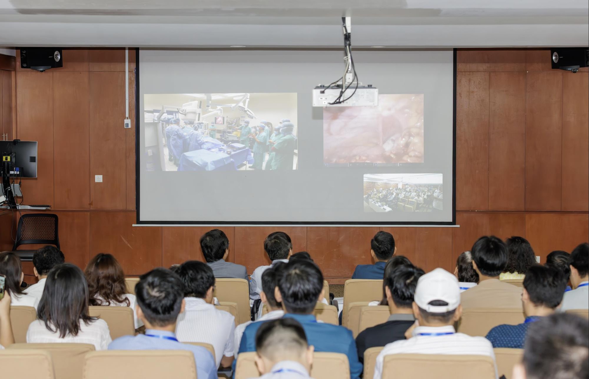 Truyền hình trực tiếp phẫu thuật cắt dạ dày bằng Robot Da Vinci Xi tại Bệnh viện FV - Ảnh 1.