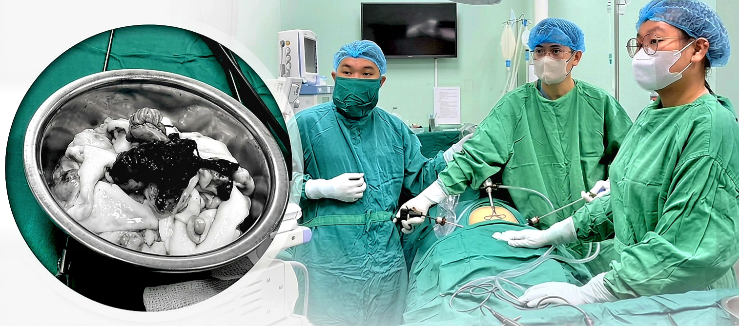 Đừng để đau bụng làm mất khả năng sinh sản - Ảnh 1.