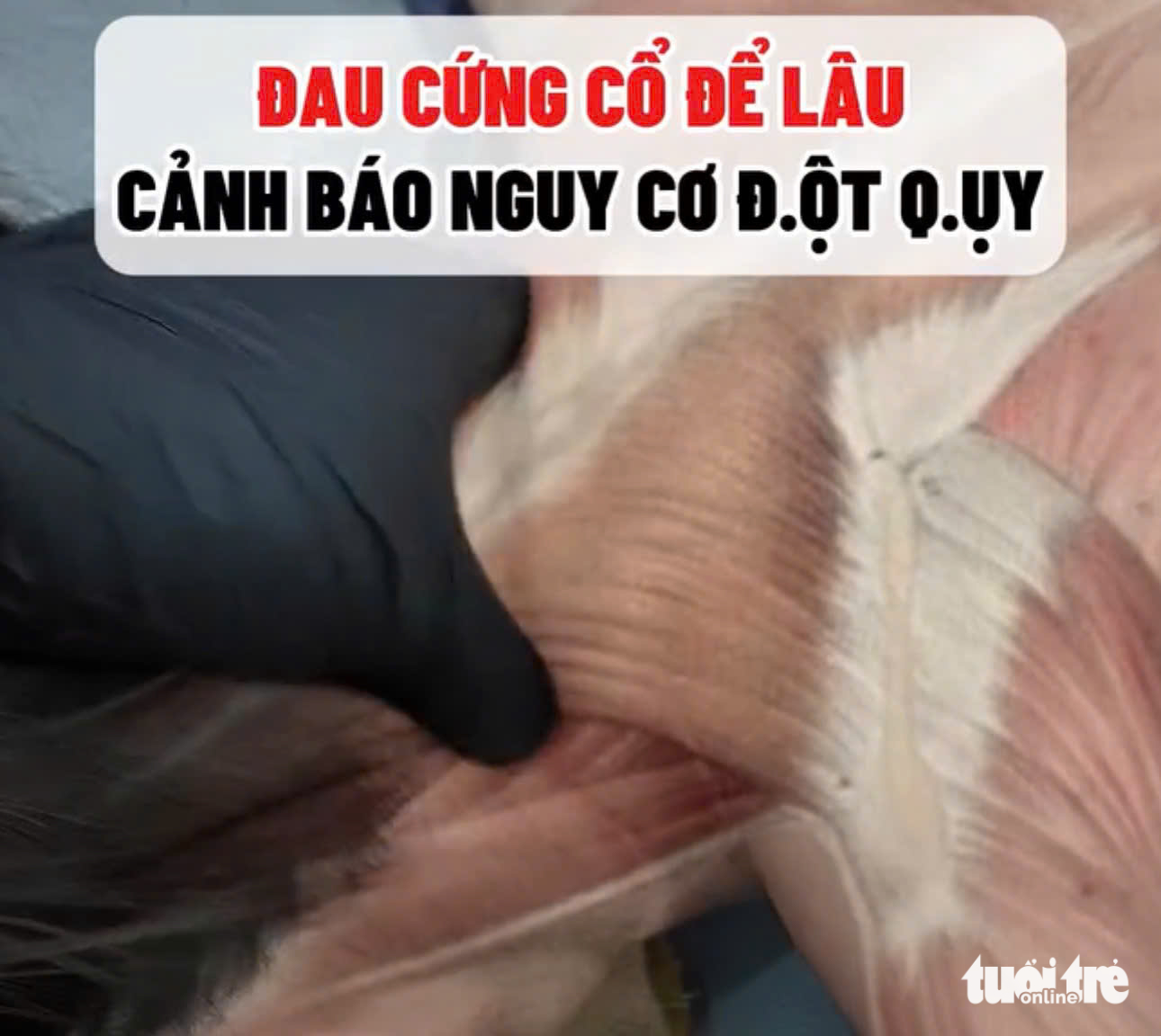 giải cơ - Ảnh 2.