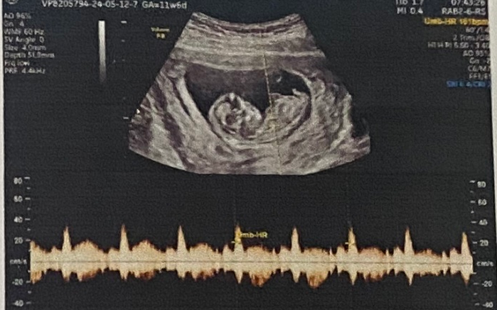 In Vietnam, revealing fetal sex is illegal except in these cases- Ảnh 2.