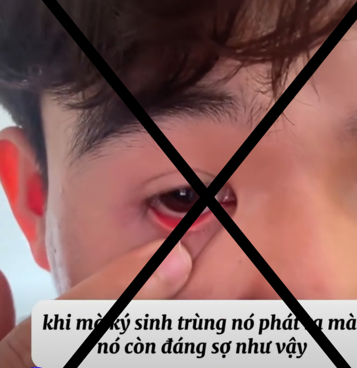 ký sinh trùng - Ảnh 1.