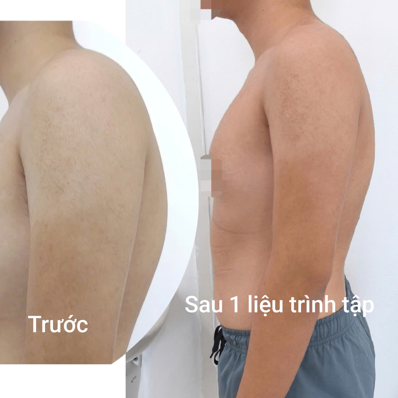 - Ảnh 1.