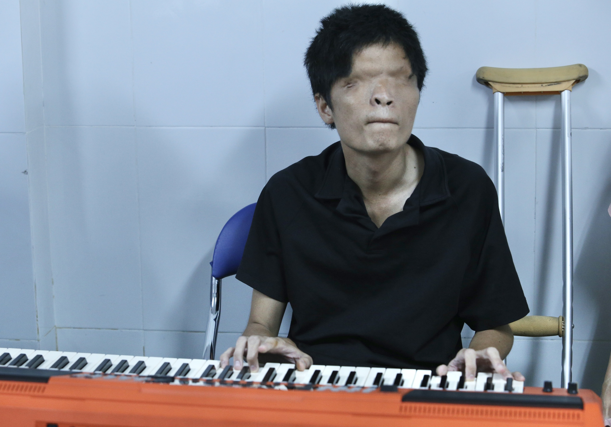 - Ảnh 11.