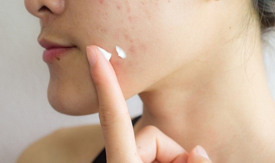 Thu hồi 5 sản phẩm mỹ phẩm của Công ty Kencare Việt Nam - Ảnh 1.