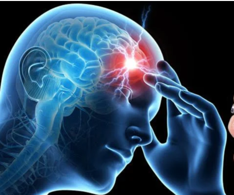 Chóng mặt, bồn nôn: Dấu hiệu đột quỵ tiểu não dễ nhầm với rối loạn tiền đình - Ảnh 1.