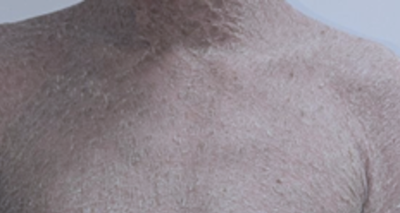 - Ảnh 1.