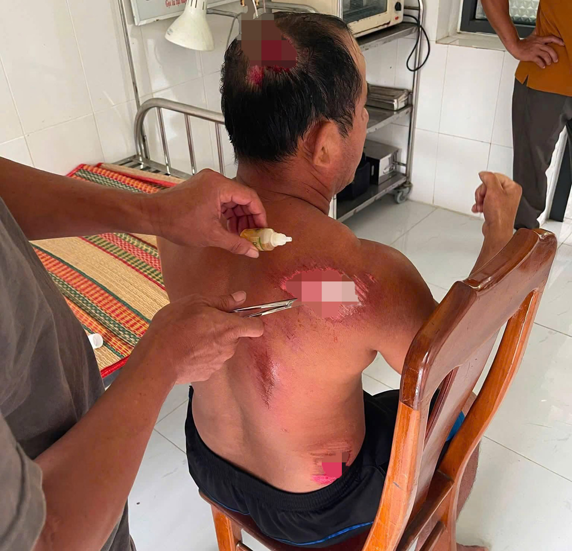 Bị tàu khác tông khiến ghe chìm, ngư dân bị thương bơi 1 hải lý - Ảnh 1.