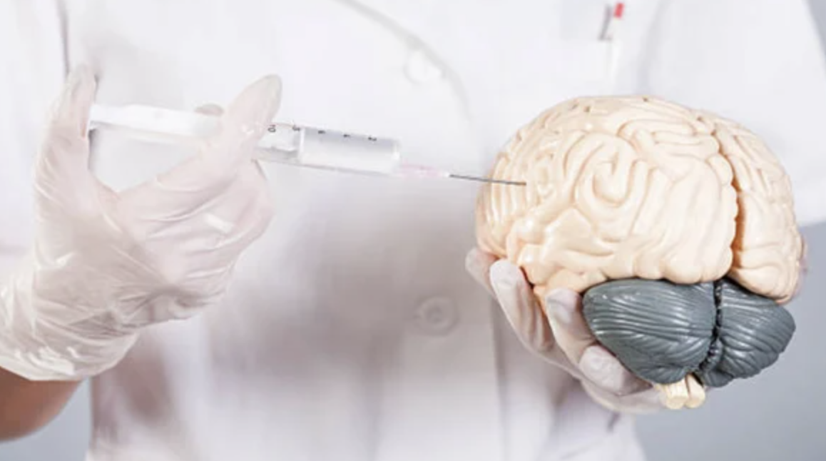 Người già đua nhau tiêm thuốc ‘bổ não’: Hiệu quả có như lời đồn? - Ảnh 1.