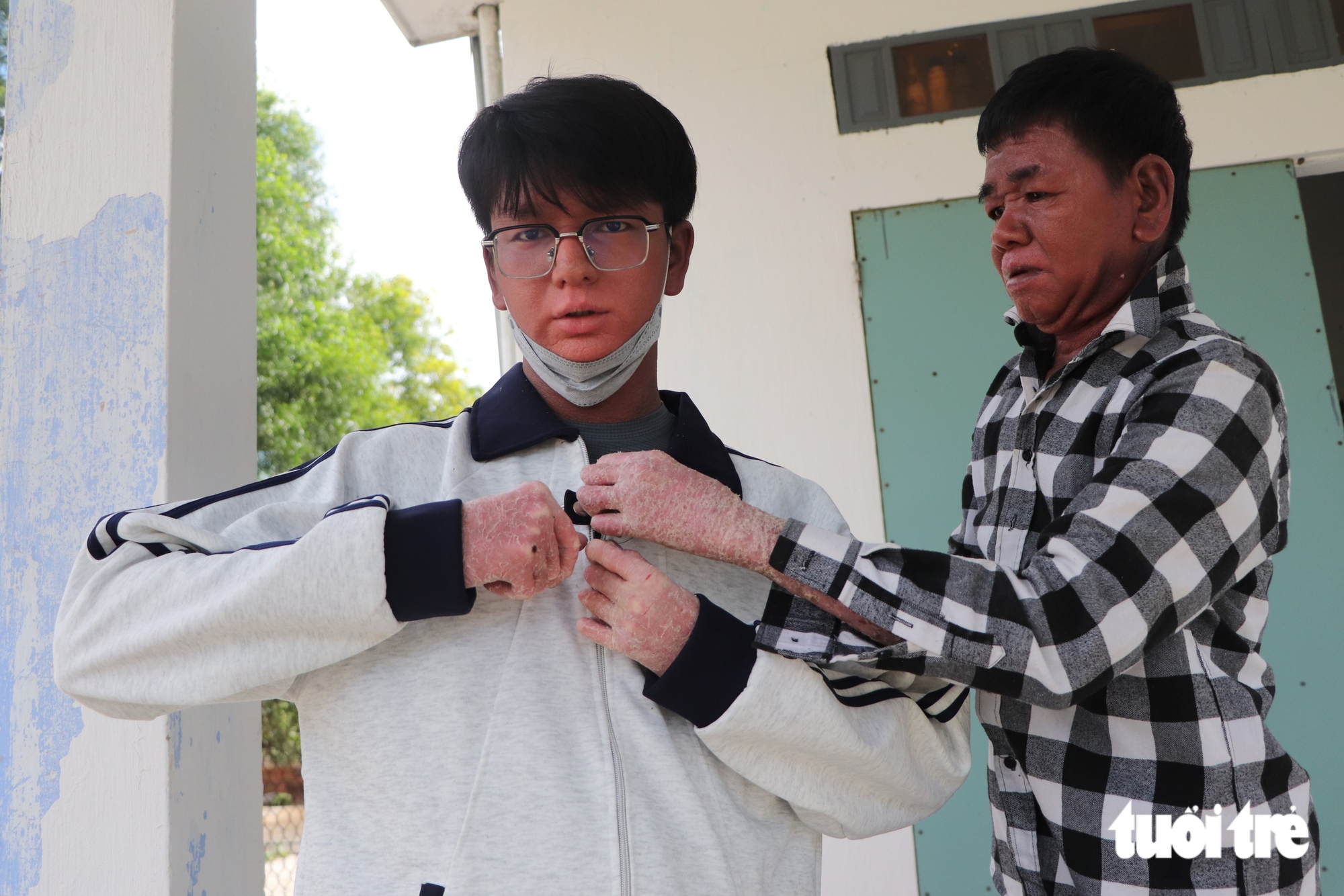 24 tuổi đời tràn ngập nỗi đau, nam sinh 'người rắn' dũng cảm bước vào đại học - Ảnh 1.