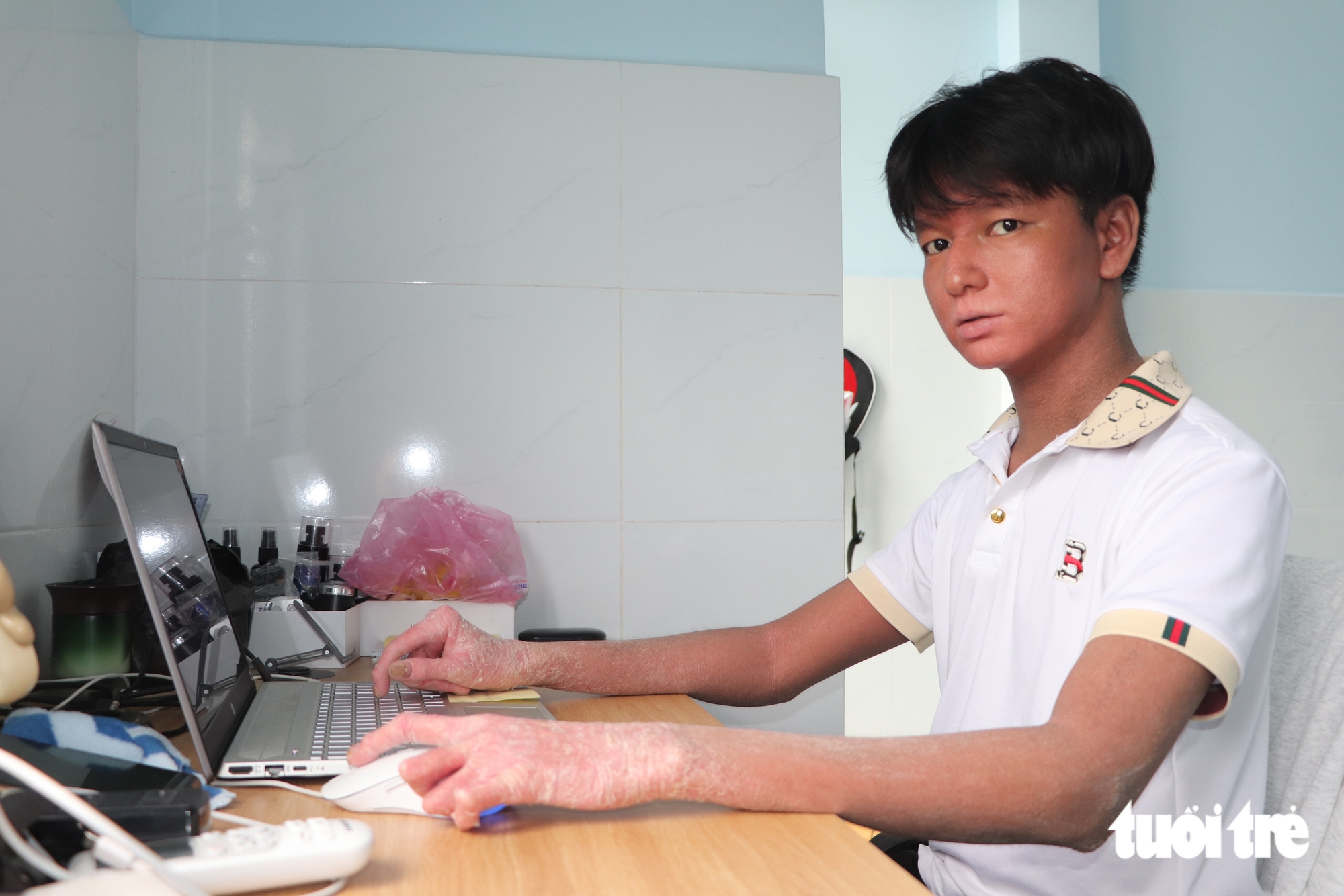 24 tuổi đời tràn ngập nỗi đau, nam sinh 'người rắn' dũng cảm bước vào đại học - Ảnh 9.