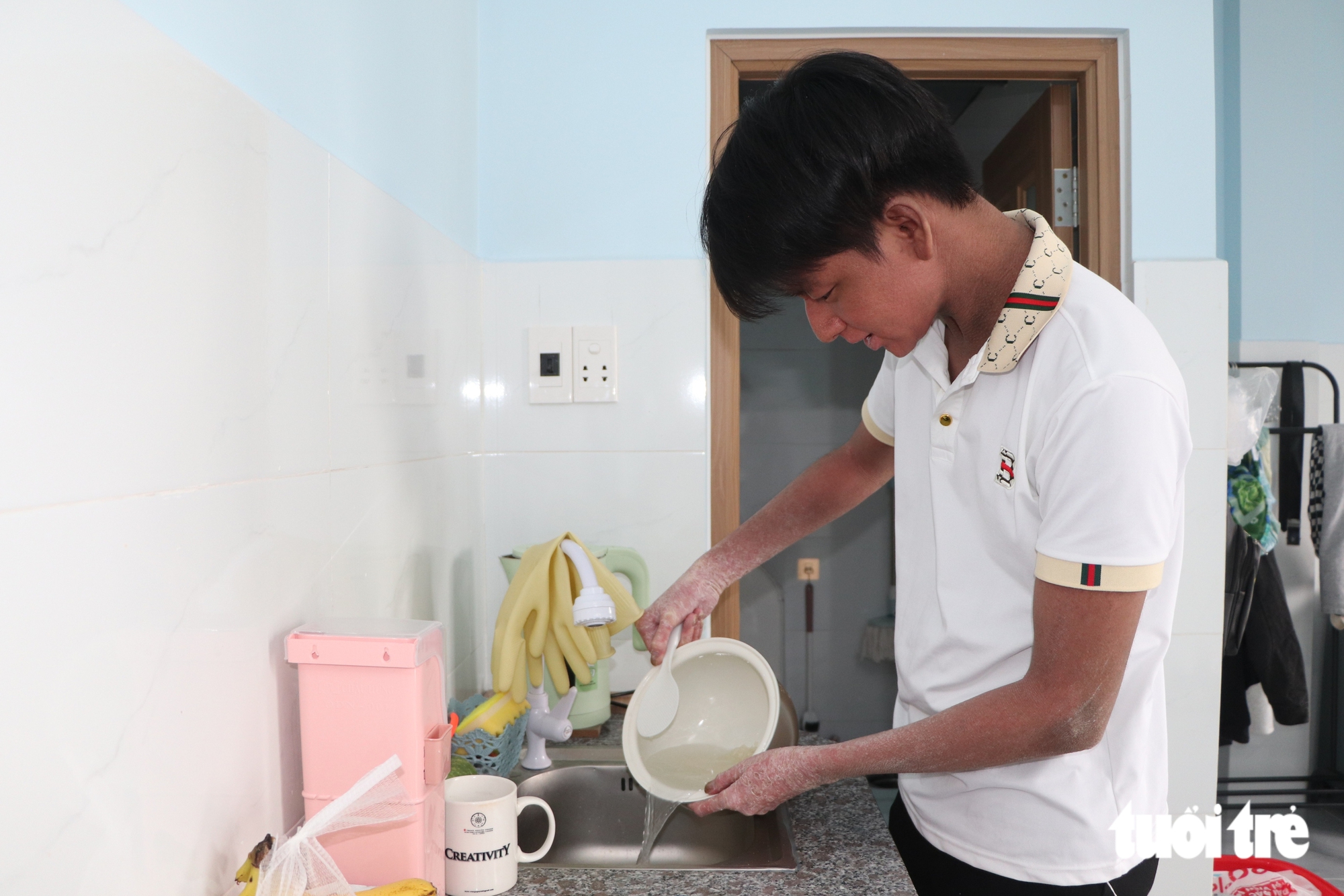 24 tuổi đời tràn ngập nỗi đau, nam sinh 'người rắn' dũng cảm bước vào đại học - Ảnh 10.