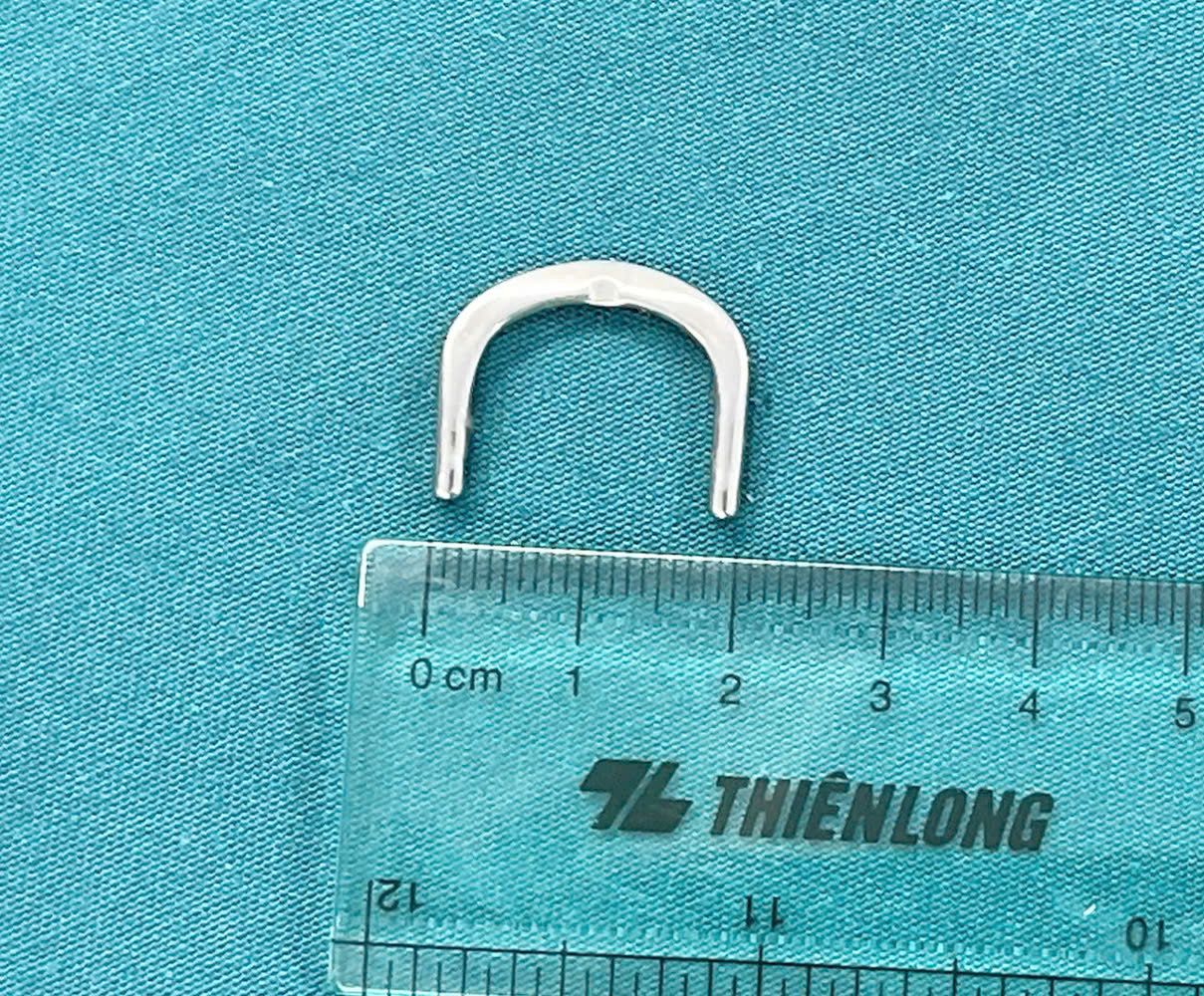 Bé gái 3 tuổi nuốt móc khóa dây đồng hồ, không chủ quan với những vật nhỏ quanh trẻ - Ảnh 1.