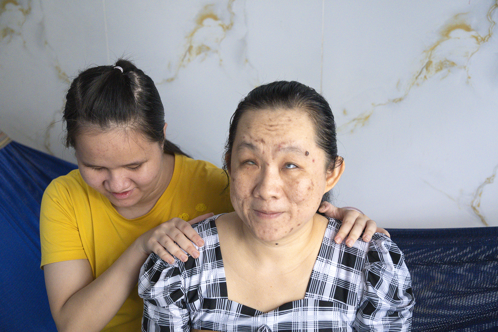 Ngôi nhà ba thế hệ nạn nhân chất độc da cam: Mắt dẫu tối, tình đời sáng - Ảnh 6.