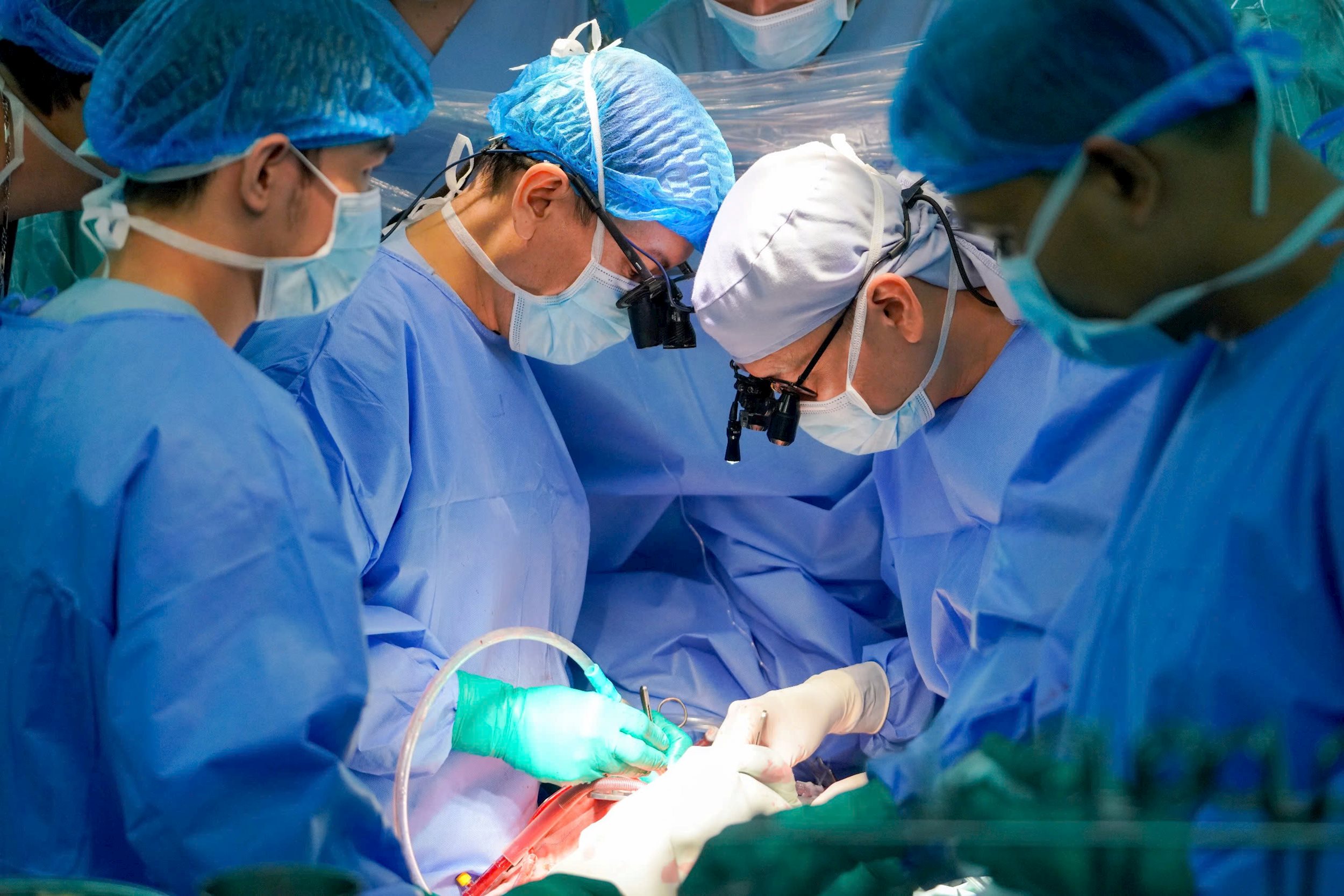 gs-ts-bs.-nguyen-hoang-dinh-pho-giam-doc-bv-dhyd-cung-ekip-thuc-hien-ghep-tim-cho-benh-nhi.jpg