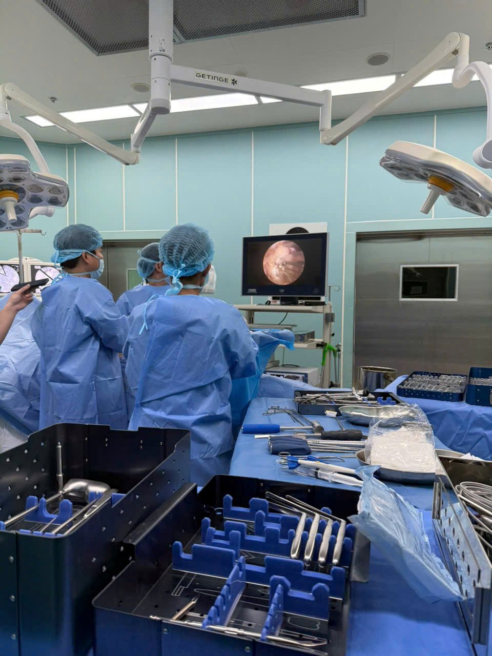 mo-khop-2.jpg