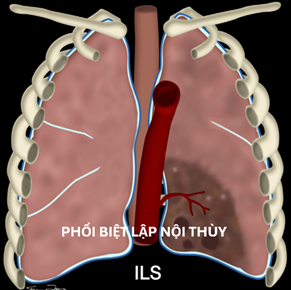 hinh-minh-hoa-phoi-biet-lap-1.png