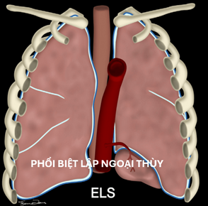hinh-minh-hoa-phoi-biet-lap-2.png